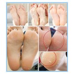 1pair baby foot mask peeling foot care renewal mask remove dead skin cuticles heel socks for pedicure